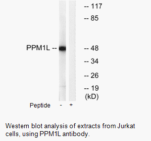 Product image for PPM1L Antibody