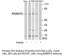 Product image for RABEP2 Antibody
