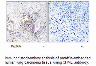 Product image for CHML Antibody