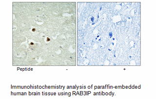 Product image for RAB3IP Antibody