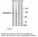 Product image for RANBP6 Antibody
