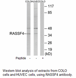Product image for RASSF4 Antibody