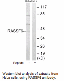 Product image for RASSF6 Antibody