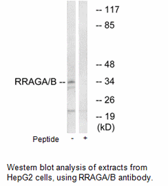 Product image for RRAGA/B Antibody