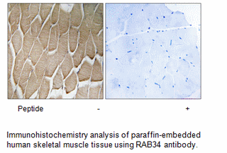 Product image for RAB34 Antibody
