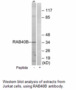 Product image for RAB40B Antibody