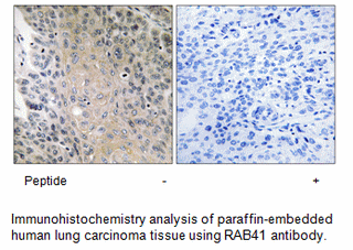 Product image for RAB41 Antibody