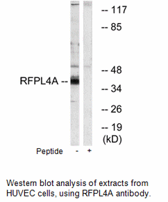 Product image for RFPL4A Antibody