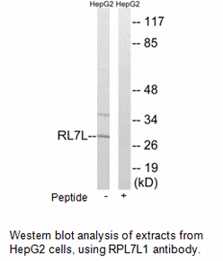 Product image for RPL7L1 Antibody