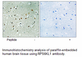 Product image for RPS6KL1 Antibody