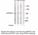 Product image for ATP2A1 Antibody