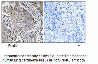 Product image for SPINK6 Antibody