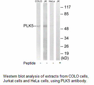 Product image for PLK5 Antibody