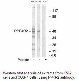 Product image for PPP4R2 Antibody