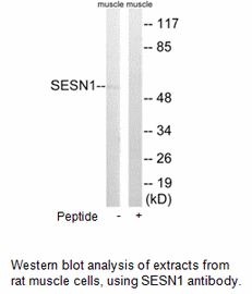 Product image for SESN1 Antibody