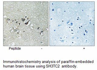Product image for SH3TC2 Antibody