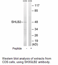 Product image for SH3GLB2 Antibody