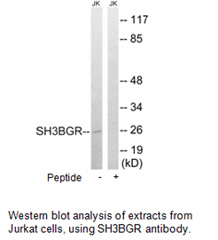 Product image for SH3BGR Antibody