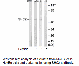 Product image for SHC2 Antibody
