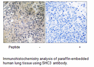 Product image for SHC3 Antibody