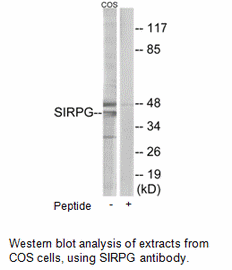 Product image for SIRPG Antibody