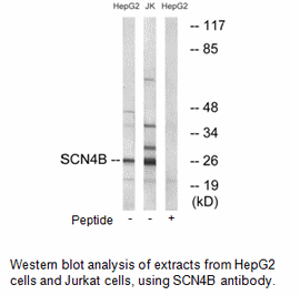 Product image for SCN4B Antibody