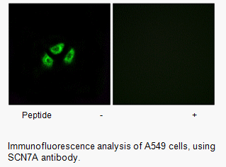 Product image for SCN7A Antibody