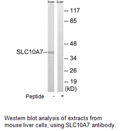Product image for SLC10A7 Antibody