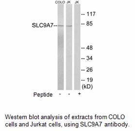 Product image for SLC9A7 Antibody