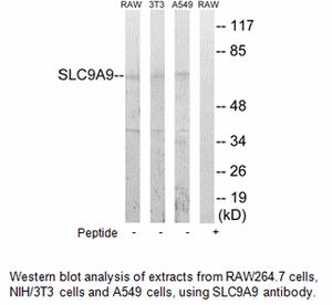 Product image for SLC9A9 Antibody