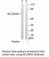 Product image for SLC28A2 Antibody