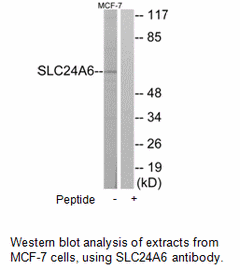 Product image for SLC24A6 Antibody