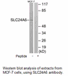 Product image for SLC24A6 Antibody