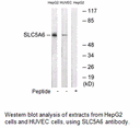 Product image for SLC5A6 Antibody