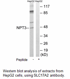 Product image for SLC17A2&nbsp;Antibody