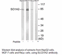 Product image for SLCO1A2 Antibody