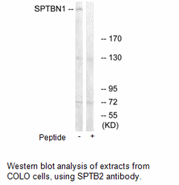 Product image for SPTBN1 Antibody