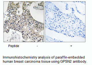 Product image for GPSN2 Antibody