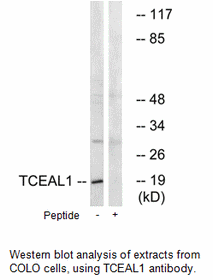 Product image for TCEAL1 Antibody