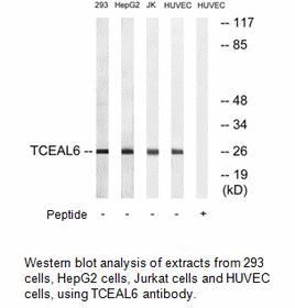 Product image for TCEAL6 Antibody