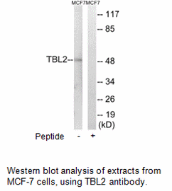 Product image for TBL2 Antibody