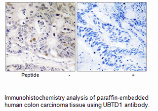 Product image for UBTD1 Antibody
