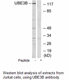 Product image for UBE3B Antibody
