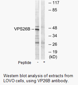 Product image for VPS26B Antibody
