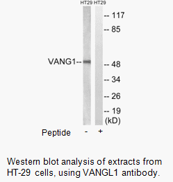 Product image for VANGL1 Antibody