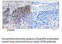 Product image for VCAN Antibody