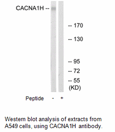 Product image for CACNA1H Antibody