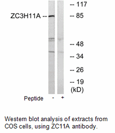 Product image for ZC3H11A Antibody
