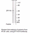 Product image for ZFYVE19 Antibody