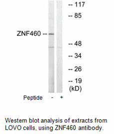 Product image for ZNF460 Antibody